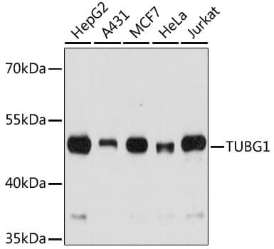 Anti-TUBG1 Antibody