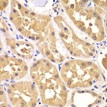 Anti-PRKAG3 Antibody