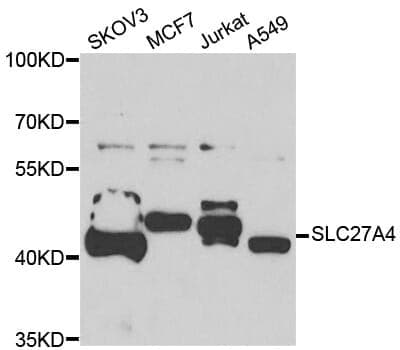 Anti-SLC27A4 Antibody