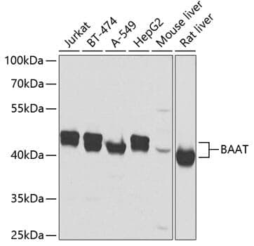 Anti-BAAT Antibody