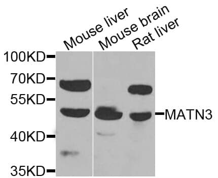 Anti-MATN3 Antibody