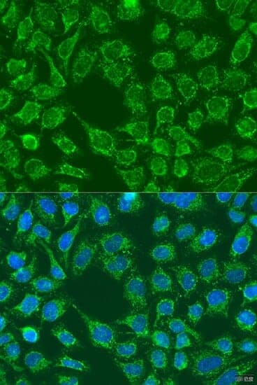 Anti-WNT7B Antibody