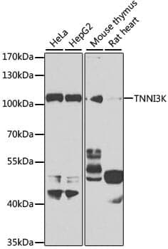 Anti-TNNI3K Antibody