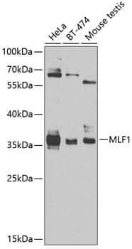 Anti-MLF1 Antibody