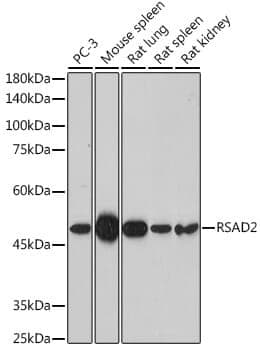 Anti-RSAD2 Antibody