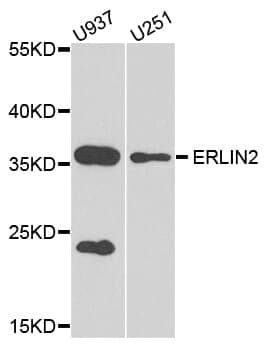 Anti-ERLIN2 Antibody