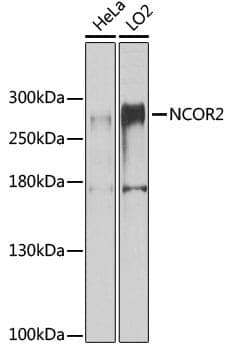 Anti-NCOR2 Antibody