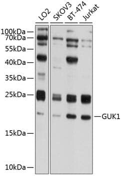 Anti-GUK1 Antibody