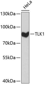 Anti-TLK1 Antibody