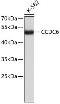 Anti-CCDC6 Antibody