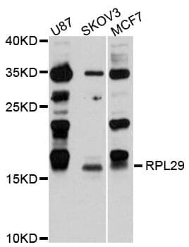 Anti-RPL29 Antibody