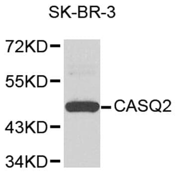 Anti-CASQ2 Antibody