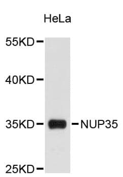 Anti-NUP35 Antibody