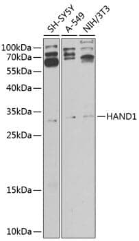 Anti-HAND1 Antibody