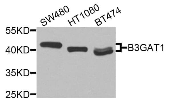 Anti-B3GAT1 Antibody