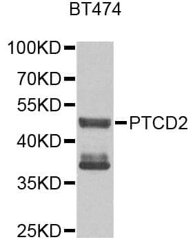 Anti-PTCD2 Antibody