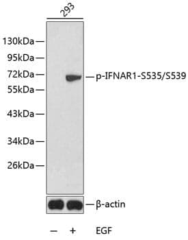 Anti-IFNAR1 (phospho S535 + S539) Antibody