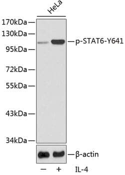 Anti-STAT6 (phospho Y641) Antibody