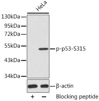 Anti-TP53 (phospho S315) Antibody