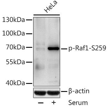 Anti-RAF1 (phospho S259) Antibody