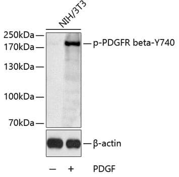 Anti-PDGFRb (phospho Y740) Antibody