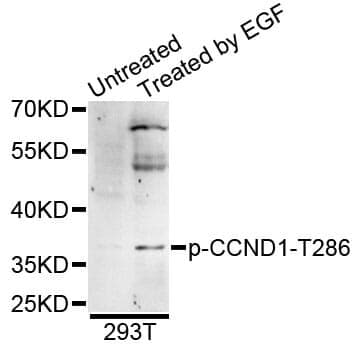 Anti-CCND1 (phospho T286) Antibody