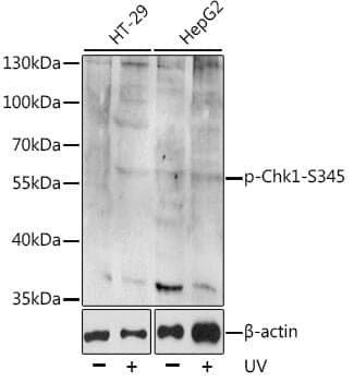 Anti-CHEK1 (phospho S345) Antibody