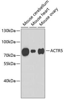 Anti-ACTR5 Antibody