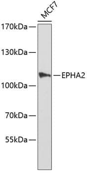 Anti-EPHA2 Antibody