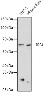Anti-IRF4 Antibody