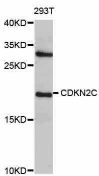 Anti-CDKN2C Antibody