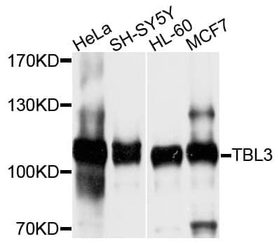 Anti-TBL3 Antibody