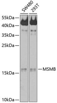Anti-MSMB Antibody