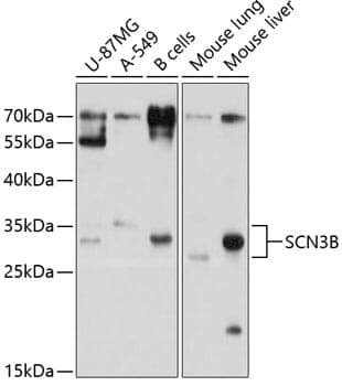 Anti-SCN3B Antibody