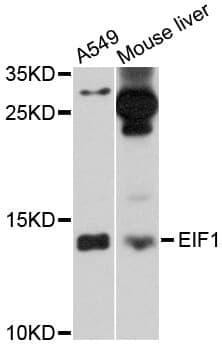 Anti-EIF1 Antibody