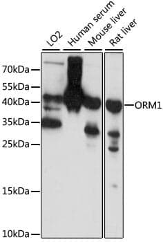 Anti-ORM1 Antibody