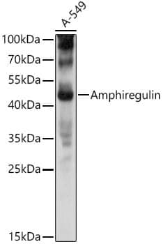 Anti-AREG Antibody