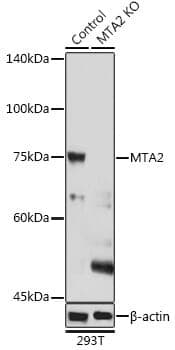 Anti-MTA2 Antibody