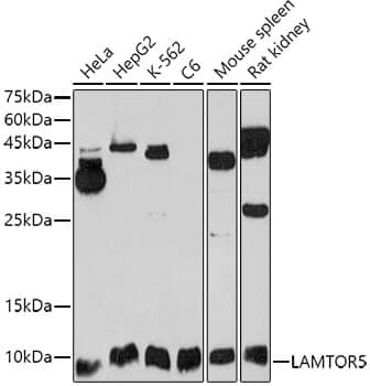 Anti-LAMTOR5 Antibody