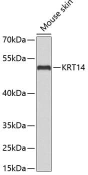 Anti-KRT14 Antibody
