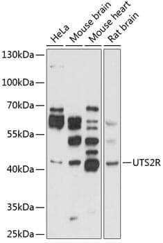 Anti-UTS2R Antibody