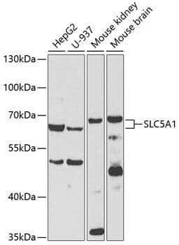 Anti-SLC5A1 Antibody