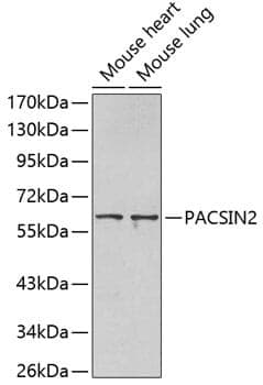 Anti-PACSIN2 Antibody