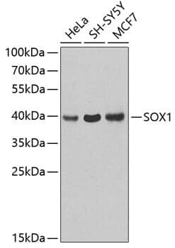 Anti-SOX1 Antibody