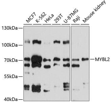 Anti-MYBL2 Antibody