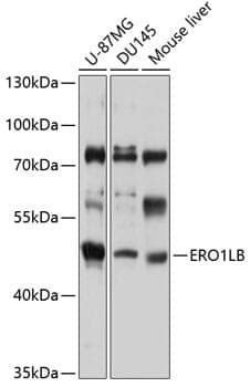 Anti-ERO1LB Antibody