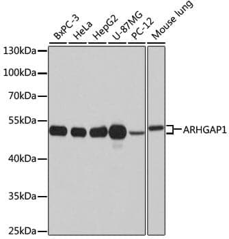 Anti-ARHGAP1 Antibody