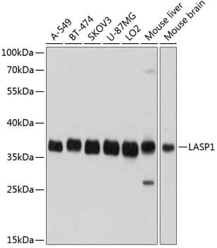 Anti-LASP1 Antibody