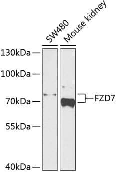 Anti-FZD7 Antibody