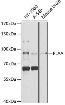 Anti-PLAA Antibody